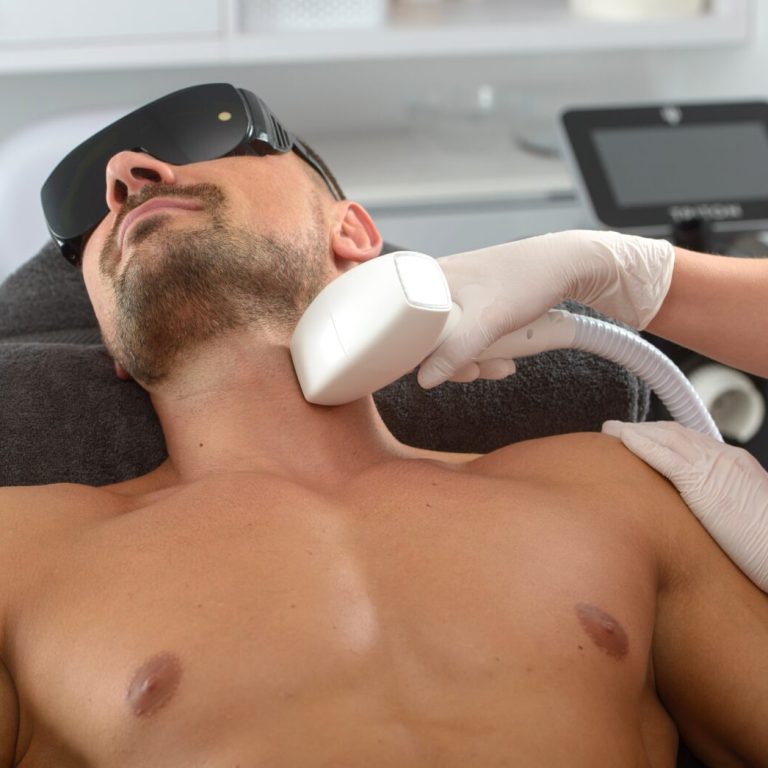 Laser,Hair,Removal,On,Mans,Neck.,Man,In,A,Goggles.